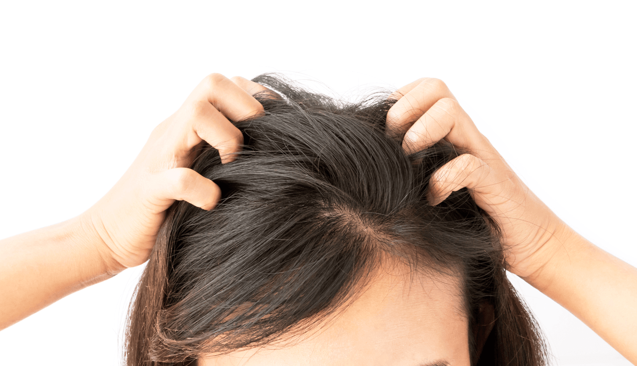 scalp uscat și tratament cu verdexedil spray